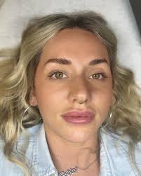 Boca Aesthetics Bar added a new photo.