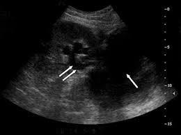 Medscape Log In Ultrasound Diagnostic Medical Sonography Sonography