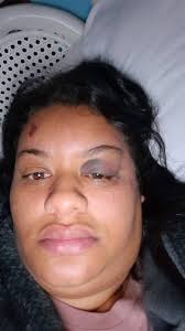 Is this what lack of evidence looks like? This is why cupcake must see how  far the rot is in the SAPS! This is Shauna Rhoda. This is her story.  Breaking My