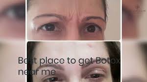 We offer a specialized holistic approach for skin, . Botox Near Me At Your Leisure Aesthetics Estetico