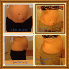 Before 1st Wrap And After 3rd On My Stomach I Had 2 C Section 14 1 2 Months Apart The Last C Section Was January 2013 My Pouch Is Almost Gone Weightlossb