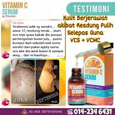 We did not find results for: Cantik Tak Perlu Suntik