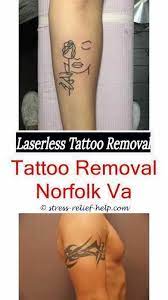 Three tattoo removal sessions for small, medium, or large area at lighten up laser (up to 60% off). Beste Tattooentfernung Phoenix Az Tattooentfernung Erste Sitzung Kann Beste Er Laser Tattoo Tattoo Removal Cost Laser Tattoo Removal