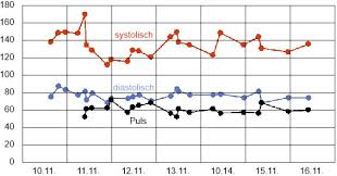 Diagramm In Excel 2010 Zeitachse Nach Stunden