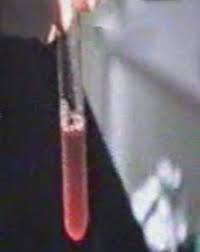 Maybe you would like to learn more about one of these? Fertilizare In Vitro Fiv