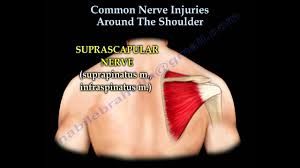 Stretching can help to release the rhomboids and alleviate the discomfort keep your hands and feet in place as you extend your hips back, which will allow your shoulders to be pulled forward. Shoulder Nerve Injury Injuries Everything You Need To Know Dr Nabil Ebraheim Youtube