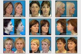 Plastic Surgery Near Me Url Https Plasticessurgery Blogspot Com 2018 11 Plastic Surgery Near Me Html Plastic Surgery Surgery Plastic