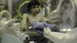 Is buried next to his brother david phillip vetter who is known as the bubble boy. Bubble Boy David Vetter Receives Bone Marrow Transplant In 1983 Video Abc News