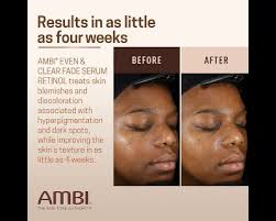 AMBI Even & Clear Fade Serum Retinol
