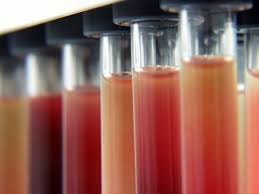 Maybe you would like to learn more about one of these? Gral Medical Sibiu Hotelul Anda Sinaia