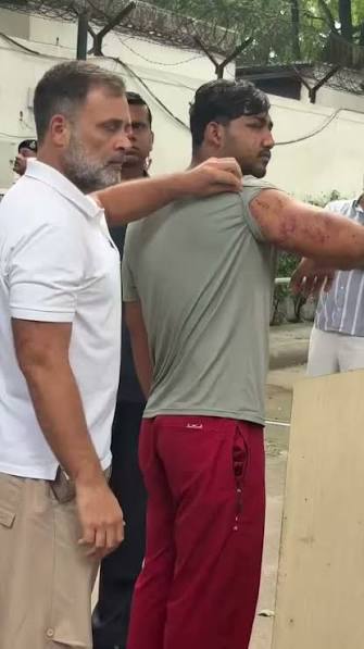 राहुल गांधी प्रोटेस्ट के दौरान पैलेट गन के शिकार हुए पीड़ित को लाए मीडिया के सामने....राहुल गांधी ने कहा-एक आंख अभी तक पीड़ित की नहीं खुल रही औऱ शरीर में कईं जगह निशान है...राहुल गांधी प्रोटेस्ट के ...