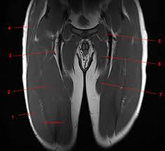 Collectively, these muscles are involved in movement and stabilisation of the. Mri Of The Thigh Detailed Anatomy Superior Part W Radiology