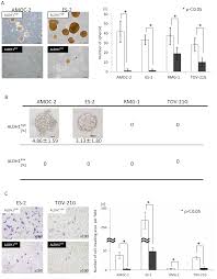 That doesn't mean cancer can't recur beyond five years. Plos One Aldh1 High Ovarian Cancer Stem Like Cells Can Be Isolated From Serous And Clear Cell Adenocarcinoma Cells And Aldh1 High Expression Is Associated With Poor Prognosis