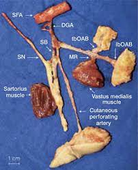 The saphenous branch of the descending genicular artery supplies the medial femoral condyle skin flap. Scielo Brasil Medial Femoral Condyle Corticoperiosteal Flap Anatomic Study Medial Femoral Condyle Corticoperiosteal Flap Anatomic Study