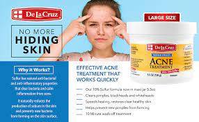 Unsere daten umfassen untersuchungen aus verschiedenen branchen sowie alle erforderlichen statistiken wie markttrends oder prognosen aus zuverlässigen quellen. Amazon Com De La Cruz 10 Sulfur Ointment Acne Treatment Medication To Clear Cystic Acne Pimples And Blackheads On Face And Body Made In Usa Jumbo Size 5 5 Oz Beauty
