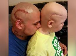 Shop 4,000+ artist designs or create your own. Dad Gets Tattoo To Match His Son S Surgery Scar Abc News