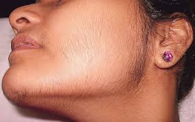 Have women 25 to 34 always been more attracted to beards than other age groups or is it more of a generational influence due to the passing. Effective And Natural Home Remedies That Can Help You Get Rid Of Facial Hair