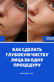 маска с желатином для лица от черных точек отзывы Kak Sdelat Glubokuyu Chistku Lica Za Odnu Proceduru Rekomenduyut Dazhe Kosmetologi Zhenskoe Zdorove Skin Health Beauty Makeup Photography Skin Care