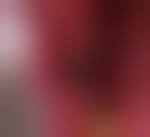 Image result for Alveolitis sicca)