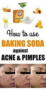 Treatment For Severe Acne With Baking Soda Natural Acne Acne Remedies Homemade Natural Acne Remedies