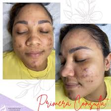 Dra. Zaida Thomas Kelly-Dermatóloga