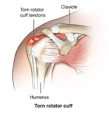 Shoulder tendons chart ~ labeled anatomy chart of shoulder ligaments on white background stocktrek images. Rotator Cuff Injury Cedars Sinai