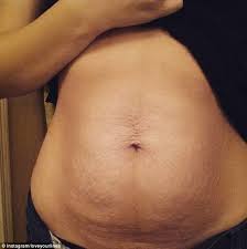 (at work) estar trabajando a toda mecha (informal); Hundreds Of Women Share Stretch Mark Photos After Chrissy Teigen Posts Hers Daily Mail Online