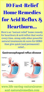 Pin On Acid Reflux Natural Remedies