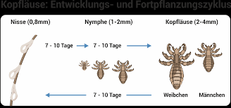 Da nissen fest am haar kleben, sind sie oft noch nach monaten als. Lause Erkennen Bekampfen Vorbeugen