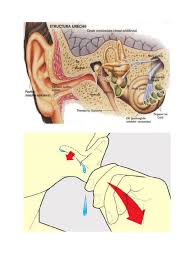 El va decide care este motivul apa oxigenata (peroxidul de hidrogen): Desfundarea Urecholor Dupa Inot
