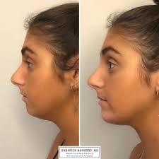 Dr. Umbareen Mahmood