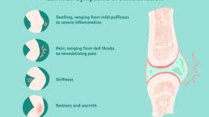 Get multiple quotes within 24 hours! Joint Effusion Symptoms Causes Diagnosis Treatment