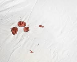 Blutungen Nach Dem Sex Was Konnen Die Ursachen Sein Frauenarztinnen Strohlein Pflanz