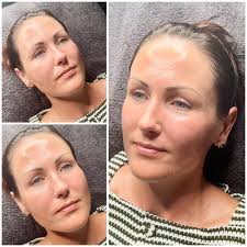 💫💫💫GLOW💫💫💫 The GLOW that everyone is asking for when they walk in.  This treatment consisted of dermaplaning and a gentle acid peel. I will  assess your skin