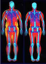 The rib cage is the arrangement of ribs attached to the vertebral column and sternum in the thorax of most vertebrates. What Is Body Composition Pritikin Weight Loss Resort
