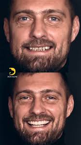 FaraFiltru a fost o seara in care am vorbit despre frumusete