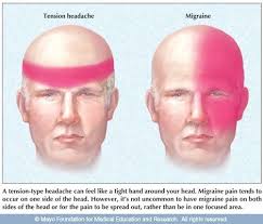 The Distinction Between A Migraine And A Tension Headache Both Are Treated With Acupuncture By Needling The Gallbladder Acupuncture Tension Headache Migraine