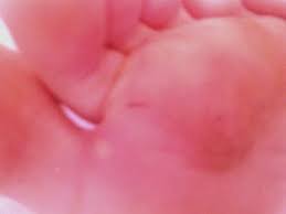 They are pure white, like vanilla ice cream. Why Do My Feet Hurt