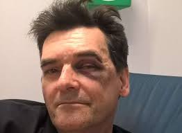 History teacher Tim Platt says horrific attack outside a Herne Bay pub in  Central Parade has left him traumatised