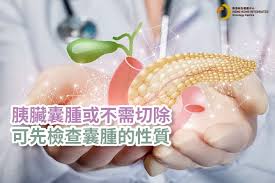 據 2017 年衛生福利部的統計，胰臟癌佔台灣癌症死亡原因的第 8 位。因胰臟位置深藏，早期的胰臟癌幾乎沒有任何症狀，所以胰臟癌又稱為「沉默的殺手」，而上腹部疼痛是胰臟癌最為常見的症狀。 危險因子. èƒ°è‡Ÿç™Œæª¢æŸ¥ èƒ°è‡Ÿç™Œç—‡ç‹€ æˆå› åŠæ²»ç™‚ é¦™æ¸¯ç¶œåˆè…«ç˜¤ä¸­å¿ƒ