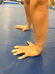 Triangular fibrocartilage complex (tfcc) injuries may be traumatic or degenerative in nature. Tfcc Gymnastics Injuries