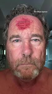 Terrifying moment photographer films himself being shot with rubber bullets  during LA riots