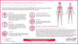 If you have stage 4 breast cancer it means that it's spread far beyond the breast and but, as research is advancing, so are the odds: Http Www Melbournebreastcancersurgery Com Au Wp Content Themes Ypo Theme Pdf Breast Cancer Recurrence New Pdf