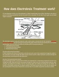 Electrolysis is a form of permanent hair removal that kills the reproductive hair cell, ensuring that the hair does not grow back. 9 Electrolysis The Secret Weapon Ideas Hair Removal Tweezing Hair Removal Permanent