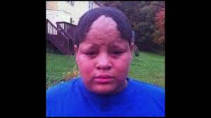 So at least have a nba player hairline roast : Funny Hairline Fails Youtube