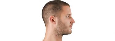 But we do more than create products. Smp Treatment In Dubai An Art Form To Treat Baldness Hair Transplant Dubai