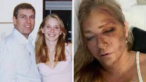 Virginia Giuffre DV breach case back in court after bus crash photo |  news.com.au — Australia's leading news site for latest headlines