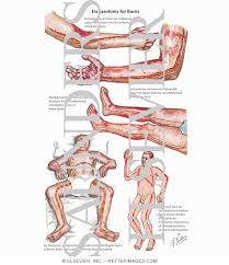 − monitor for return or preservation of circulation (limb) or breathing (chest). Escharotomy For Burns