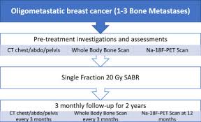 Many times, the first symptom a woman notices is pain in certain bones, including the: Stereotactic Ablative Body Radiotherapy Sabr For Bone Only Oligometastatic Breast Cancer A Prospective Clinical Trial The Breast