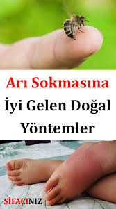 Ari Sokmasi Bazi Kisilerde Alerjik Reaksiyonlara Neden Olur Bu Kisilere Uzmanlar Tarafindan Mudahale Edilmelidir Alerjisi Olmaya Saglik Urunleri Dogal Saglik